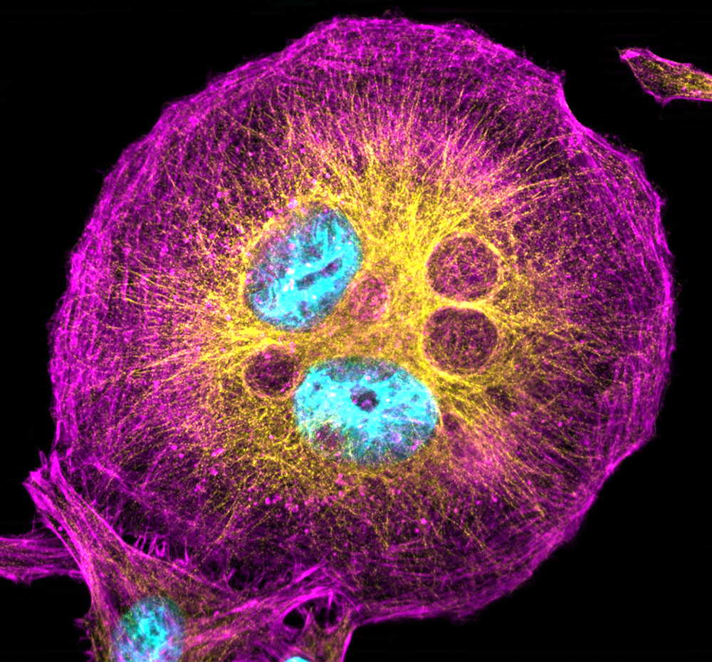 HeLa-Cytoskeleton-Immunofluorescence
