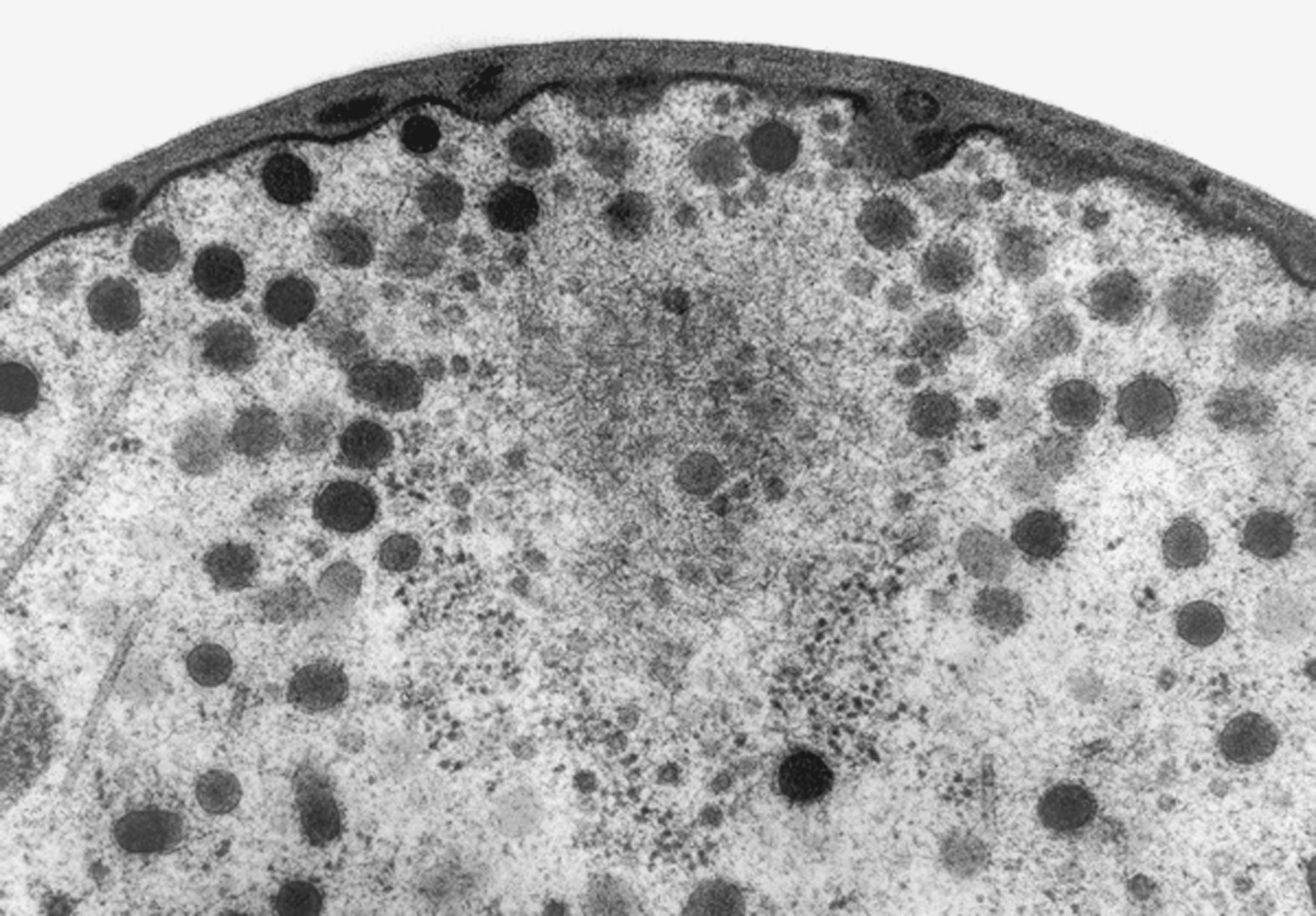 TEM fungal hyphal tip