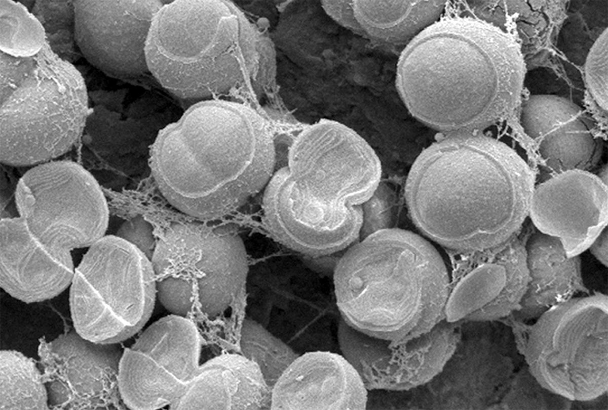 CryoSEM of Synechocystis sp PCC 6803